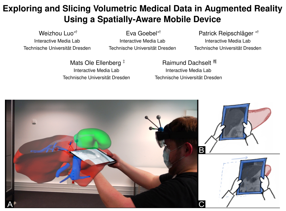 Exploring and Slicing Volumetric Medical Data in Augmented Reality
Using a Spatially-Aware Mobile Device